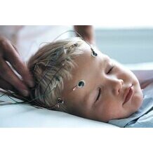 Verwendung der Ambu Neuroline 726 Cup-Elektroden